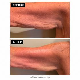 Cellulite Massage Oil Restore Texture and Elasticity