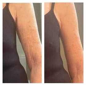 Cellulite Massage Oil Restore Texture and Elasticity